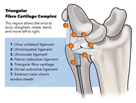 triangular fibrocartilage complex tfcc tear test|triangular fibro complex cartilage tear.